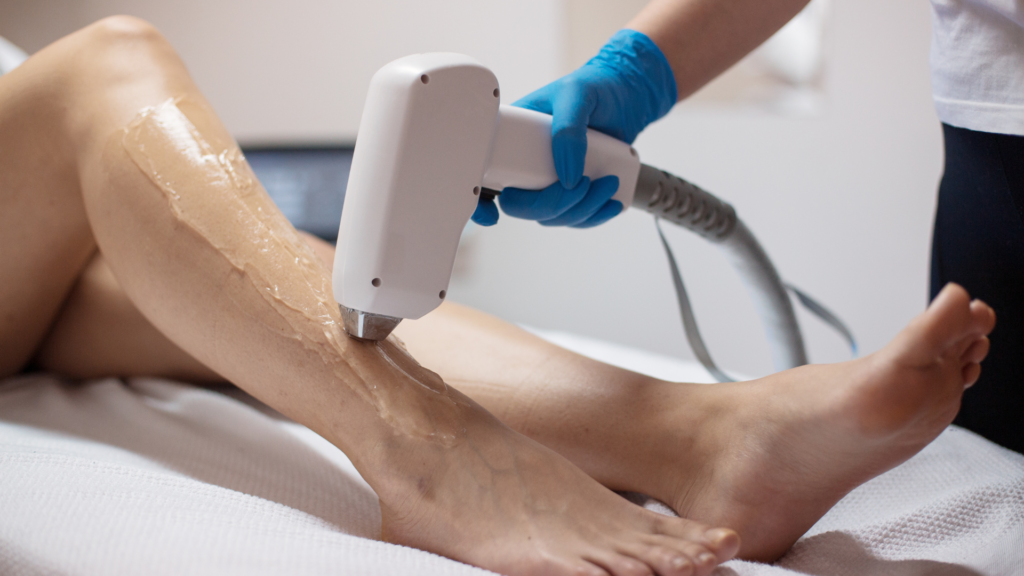 Laser Hair Removal